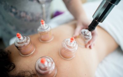 Qué es el ‘Cupping’ y por qué se ha puesto de moda, según COFENAT