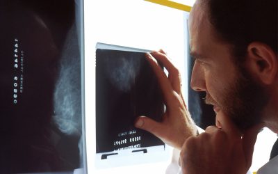 El cáncer de próstata es el principal en los hombres y no tiene relevancia institucional ni mediática