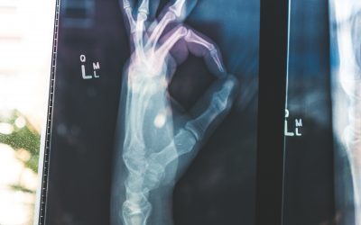 Noruega, el ejemplo a seguir por España en cuanto a regulación de los profesionales de la Osteopatía, según COFENAT