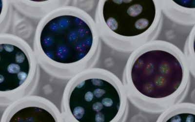 Dr. Alonso Poza: “La obesidad podría estar relacionada con el cáncer de hígado”